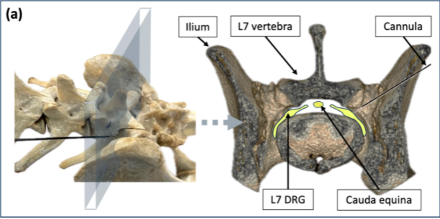 Lumbosacral foraminal injection in dogs